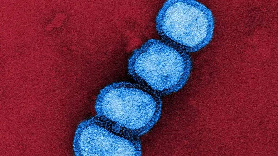 인플루엔자 A(H1N1) 바이러스 전자현미경 사진